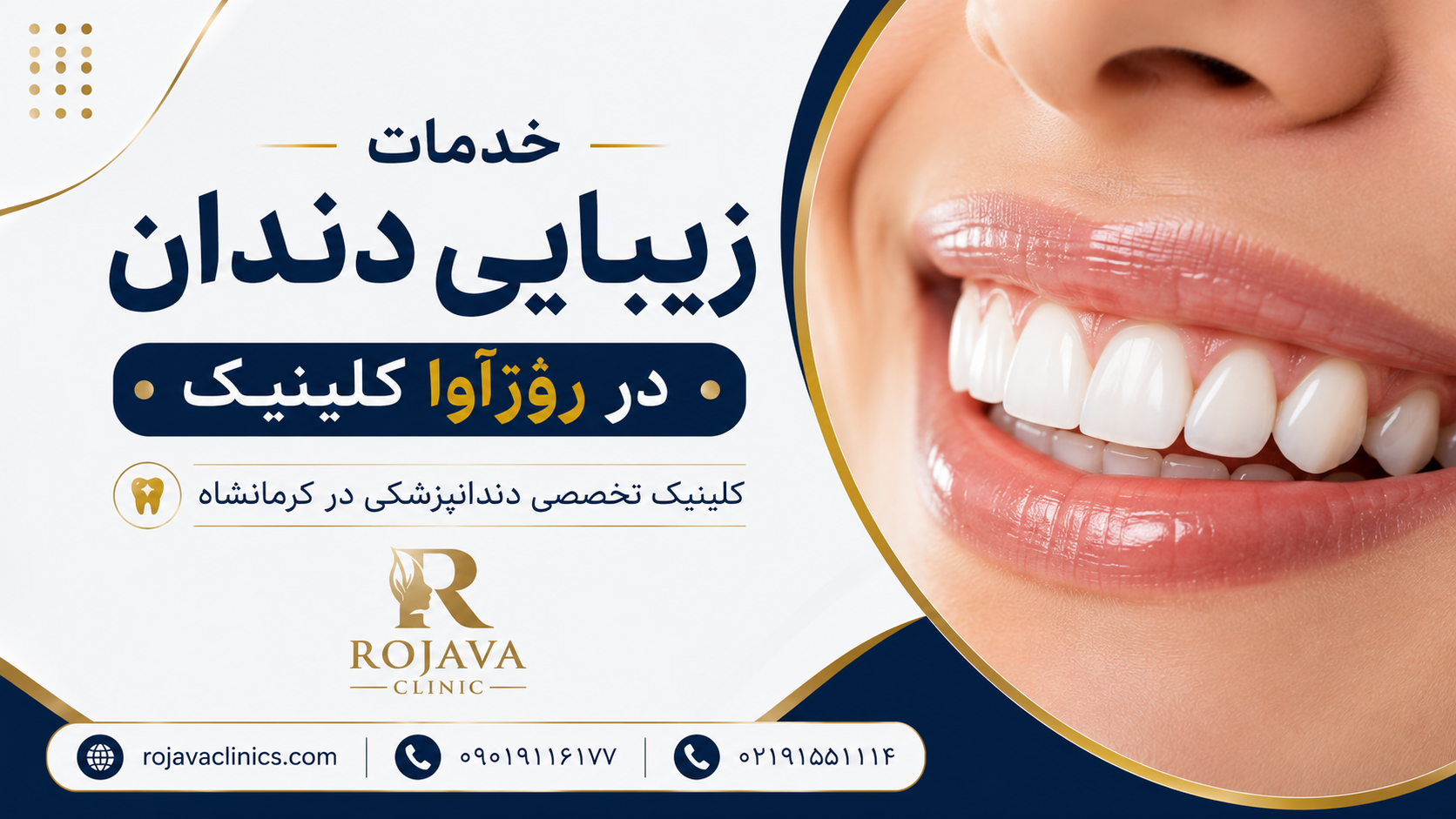 خدمات طرح لبخند در https://rojavaclinics.com کلینیک تخصصی دندانپزشکی در کرمانشاه