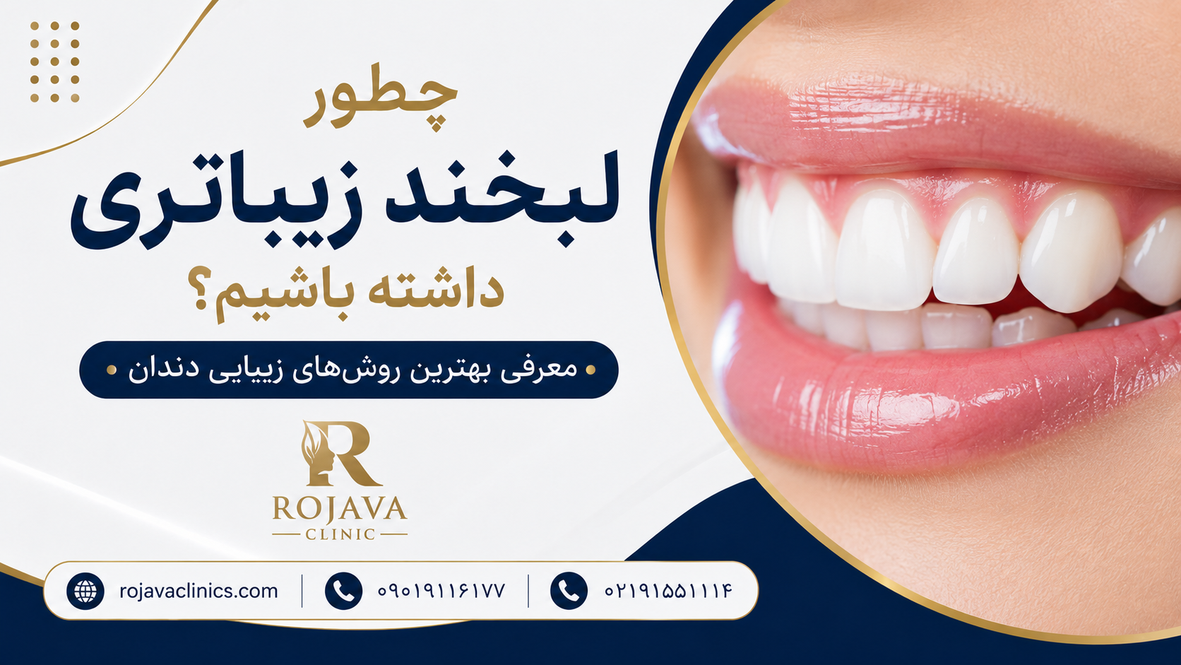 معرفی بهترین روش های طرح لبخند؛ روش ها و مراحل